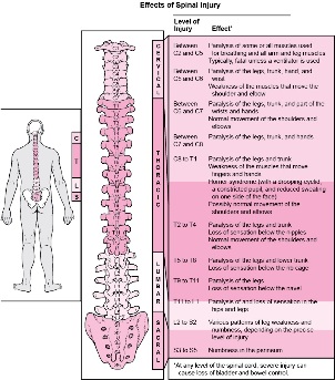 Diseases in the body associated with damage to various parts of the spine. 