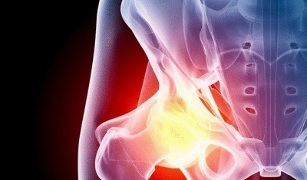 causes of the development of hip osteoarthritis