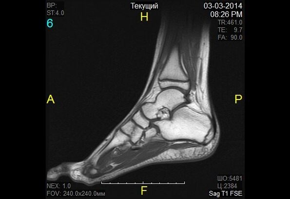 ankle imaging for osteoarthritis