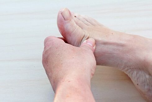 osteoarthritis of the foot