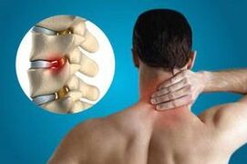 Nong of the vertebrae