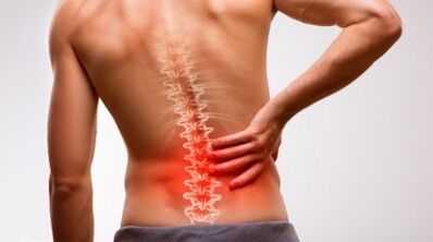 Signs and symptoms of the osteochondrosis of the lumbar column